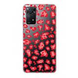 Manitoba Xiaomi Redmi Note 11 Pro/Note 12 Pro 4G ile Uyumlu Leopar Desen Tasarımlı Baskılı Şeffaf Telefon Kılıfı
