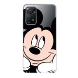 Manitoba Xiaomi Redmi Note 11 Pro/Note 12 Pro 4G ile Uyumlu Mickey Tasarımlı Baskılı Şeffaf Telefon Kılıfı