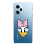 Manitoba Xiaomi Redmi Note 12 Pro 5G ile Uyumlu Daphne Tasarımlı Baskılı Şeffaf Telefon Kılıfı