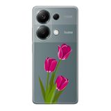 Manitoba Xiaomi Redmi Note 13 Pro 4G ile Uyumlu Baskılı Yumuşak Silikon Şeffaf Telefon Kılıfı, Lale Deseni