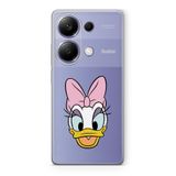 Manitoba Xiaomi Redmi Note 13 Pro 4G ile Uyumlu Daphne Tasarımlı Baskılı Şeffaf Telefon Kılıfı