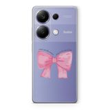 Manitoba Xiaomi Redmi Note 13 Pro 4G ile Uyumlu Fiyonk Tasarımlı Baskılı Şeffaf Telefon Kılıfı