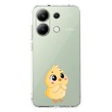 Manitoba Xiaomi Redmi Note 13 Pro 4G Uyumlu Baskılı Yumuşak Silikon Şeffaf Telefon Kılıfı, Sarı Civciv Desen