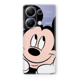 Manitoba Xiaomi Redmi Note 13 Pro 4G Uyumlu Mickey Tasarımlı Baskılı Şeffaf Silikon Telefon Kılıfı