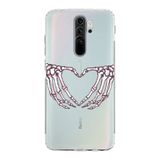 Manitoba Xiaomi Redmi Note 8 Pro Uyumlu İskelet Kalp Tasarımlı Baskılı Şeffaf Telefon Kılıfı, Çok Renkli