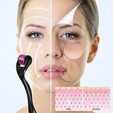 MarkEntegra Derma Roller - 1.0mm, 540 Mikro Iğne