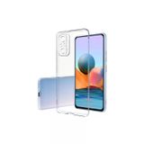 Marsilyan Xiaomi Redmi Note 10 Pro Kılıf Lüx Şeffaf Silikon