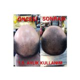 mavi serum Mavi Saç Bakım Serumu Saç Çıkaran Mavi Su