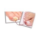 M&B Tırnak Mantar Serumu 20 ml Doğal Formül ile Tırnakları Güçlendiren Koruyucu Etki