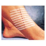 Medikal 3m Steri-Strip Dikiş Bantları 6mm X 100mm 10 Adet Şerit R1546