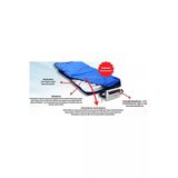 MEDİKALCİM Respirox RHP-04 Pozisyon Veren Boru Tipi Havalı Yatak Respirox