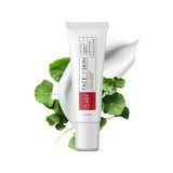 Mena Rise Clasycare Akne Kremi Yüz Için – Sivilce ve Akne Karşıtı Leke Kremi – Salisilik Asit & Niasinamid ile Leke Giderici – Genç ve Yetişkin Cilt Bakımı, 40 ml