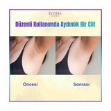 Mena Rise Elysian Essence Cilt Beyazlatıcı | Kararma Giderici Krem 3'lü Set - Genital Bölge, Koltuk Altı, Bikini Bölgesi, Dirsek ve Vücut 100 ml