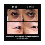 Mena Rise Faq Mikroiğneli Kırışıklık Karşıtı Hyaluronik Asit Göz Altı Pedleri – Göz Altı Şişlikleri ve Morluklara Karşı Pedler – Anında Etki – Seyahat Dostu – 3x2 Adet