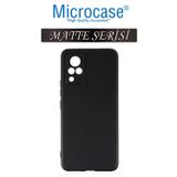 Microcase Vivo V21 4g Matte Serisi Silikon Tpu Kılıf - Siyah