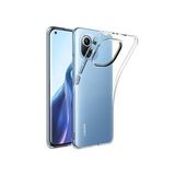 Microcase Xiaomi Mi 11 Youth İnce 0.2 Mm Soft Silikon Kılıf Şeffaf