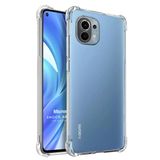 Microsonic Xiaomi Mi 11 Lite Shock Absorbing Şeffaf Kılıf