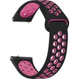 Microsonic Xiaomi Mi Watch Rainbow Gently Band Siyah Pembe Kordon