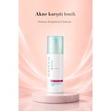 Mirra Yağlı ve Akneye Eğilimli Ciltler İçin Yüz Toniği Gözenek Sıkılaştırıcı Siyah Nokta Karşıtı Azelaik Asit 150 ml