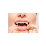 Miya-etic Diş Teli Lastiği 1/4 4.5oz Medium 6.4mm - Ortodonti Lastiği- Elastik Rondel - Ağız içi Lastik 100ad