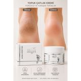 MOON ANGEL Ayak Çatlak Kremi Topuk ve Ayak Bakım Kremi Yoğun Nemlendirici 150 ml