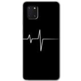 MRCİLETİSİM mrc19464 Heart Rytm Kılıf Baskılı Kapak 5D Tam Kaplayan Cam Samsung Galaxy Note 10 Lite ile uyumlu