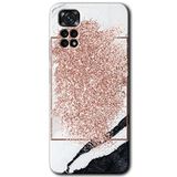 MRCİLETİSİM mrc81685 Simli Mermer Kılıf HD Desen Baskılı Arka Kapak+Temperli Cam Xiaomi Redmi Note 11s 5G Global ile uyumlu