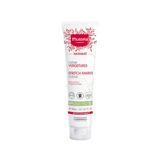 Mustela Stretch Marks Çatlak Önleyici Krem 150 ml