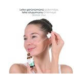 MWX Teknoloji Zaroza Leke ve Yaşlanma Karşıtı Arbutin & Vitamin C Cilt Aydınlatıcı Serum 30 ml - Option-1