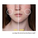 Myg Plus 30 ml Niacinamide Içeren Cilt Serumu, Yenileyici Özellik