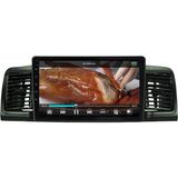 Myway Araç Multimedya Toyota Corolla Android 12 Carplay 4gb Ram + 64GB HDD 2002-2006 Navigasyon Ekran Myw