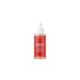 Nacific 50 ml Origin Red Salicylic Acid Serum Leke ve Gözenek Serumu