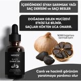Nedox 50 ml Kara Sarımsak Yağı Dökülen Saçlar İçin Besleyici Etkili Doğal İçerik