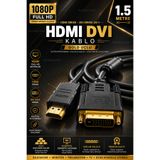 nelerbulurum YÜKSEK KALİTELİ 1.5 METRE HDMI - DVI ERKEK 24+1 ÇEVİRİCİ 1080P FULL HD Tv Pc Projektör Ps5 Ps4 Ps3 HDMI Kablo