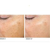 Neostrata Enlighten Illuminating 30 ML Leke Giderici Serum