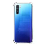 Nettech Oppo Reno 3 Pro Uyumlu Rarroz Seri Arka Koruma Kılıf Nt-88067