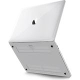 Newface Macbook Pro 16.2 2021 Şeffaf Buzlu Kapak