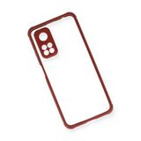 Newface Xiaomi Mi 10T Pro Miami Şeffaf Silikon Fuşya Cep Telefonu Kılıfı