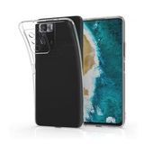 Newface Xiaomi Poco X3 GT Lüx Şeffaf Silikon Cep Telefonu Kılıfı
