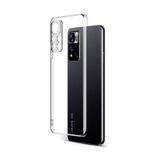 Newface Xiaomi Redmi Note 11 Pro Plus 5G Lüx Şeffaf Silikon Cep Telefonu Kılıfı