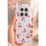 Nezih Case Redmi Note 15 Pro 5G Uyumlu Yumuşak Silikon Şeffaf Tasarım Zarif Kapak, Kalpli Kiraz