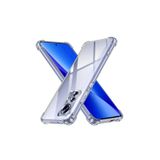 Nezih Case Xiaomi Mi 12 Lite Uyumlu Köşe Korumalı Antishock Airbag Şeffaf Sert Kapak Kılıf