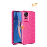 Nezih Case Xiaomi Redmi Note 11 Pro 4G ile Uyumlu Kamera Korumalı Simli Parlak Pembe Kılıf