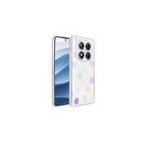Nezih Case Xiaomi Redmi Note 14 Pro 4G ile Uyumlu Kılıf, Şeffaf Figürlü Sert Kapak, Papatya
