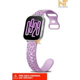 Nezih Case Xiaomi Redmi Watch 4 / 5 / 6 / Band 8 Pro / Uyumlu Leopar Desenli Silikon Kordon - Redmi Watch 4 / 5 Mi Band 8 / 9 Pro - Lila