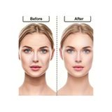 NİRA VERO 48lı yüz germe bandı ,alın,yanak,göz altı,boyun,ince kırışıklık kaldırma,düğün ve özel günler önce