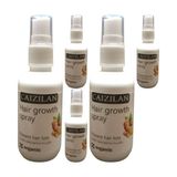 No7trend Hair Growth Spray 5 Adet Zencefil Özlü Saç Boyutu Için Sprey 50 ml - 5li