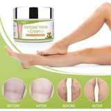 Norino Varicose Veins Var.is Kremi 100 ml - Belirtilmemiş