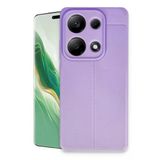 Northcity Xiaomi Redmi Note 13 Pro 4G Uyumlu Kılıf Auto Focus Kapak - Lila