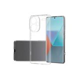 Northcity Xiaomi Redmi Note 13 Pro Plus Uyumlu Kılıf Lüx Şeffaf Silikon